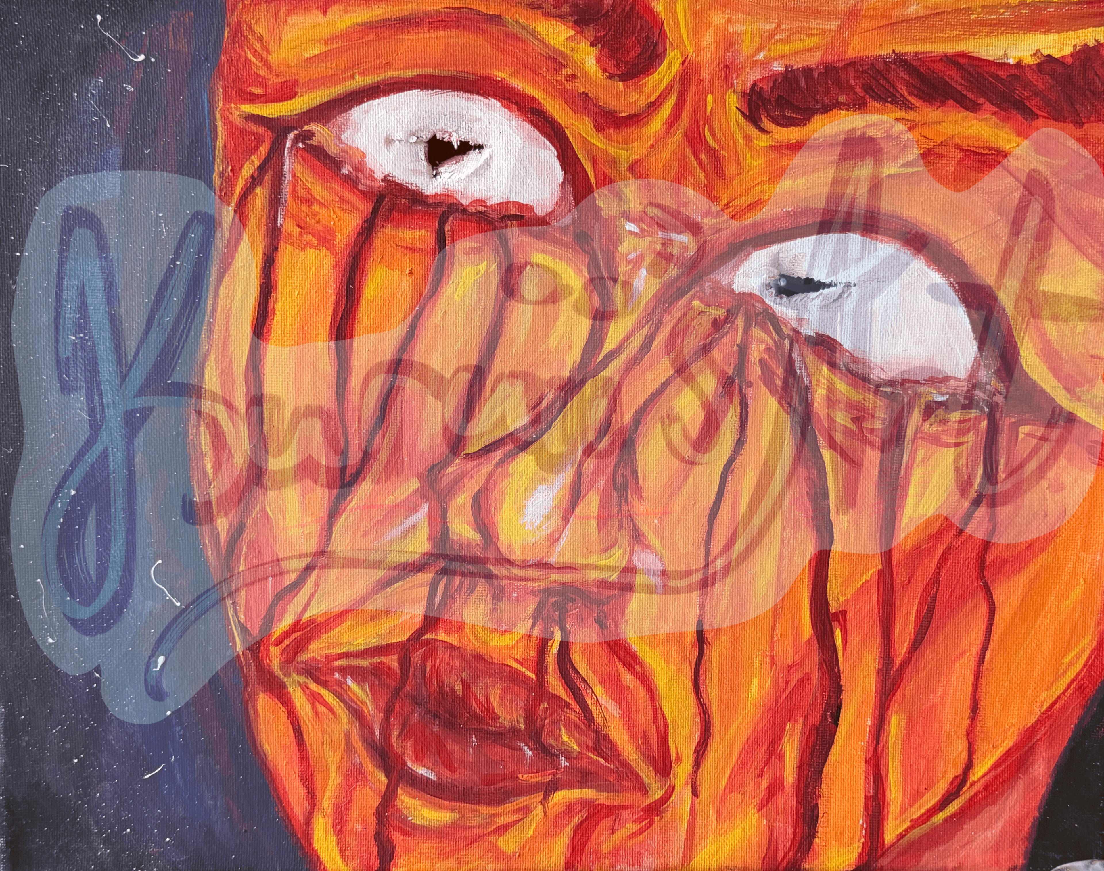 Burncloseup